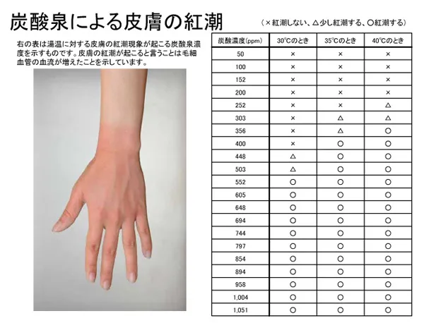 炭酸泉による美容と健康のメカニズム